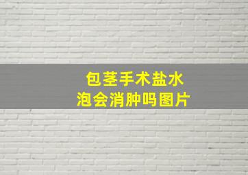 包茎手术盐水泡会消肿吗图片