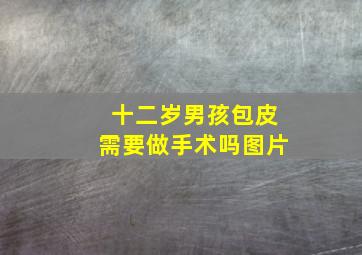 十二岁男孩包皮需要做手术吗图片