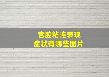 宫腔粘连表现症状有哪些图片