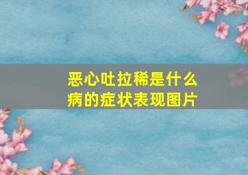 恶心吐拉稀是什么病的症状表现图片