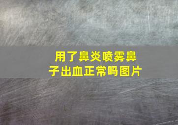 用了鼻炎喷雾鼻子出血正常吗图片