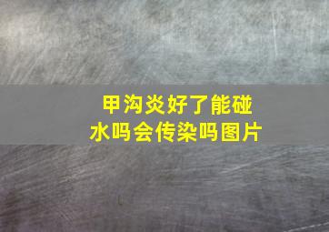 甲沟炎好了能碰水吗会传染吗图片