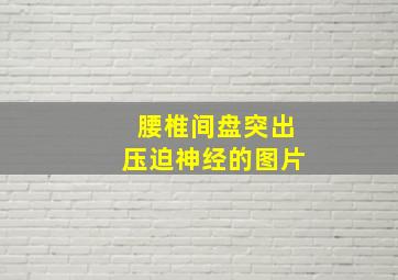 腰椎间盘突出压迫神经的图片