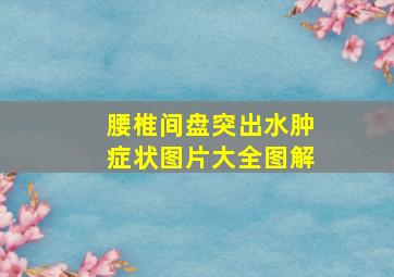 腰椎间盘突出水肿症状图片大全图解