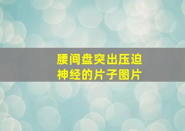 腰间盘突出压迫神经的片子图片