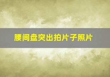 腰间盘突出拍片子照片