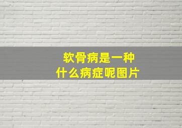 软骨病是一种什么病症呢图片