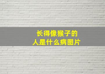 长得像猴子的人是什么病图片